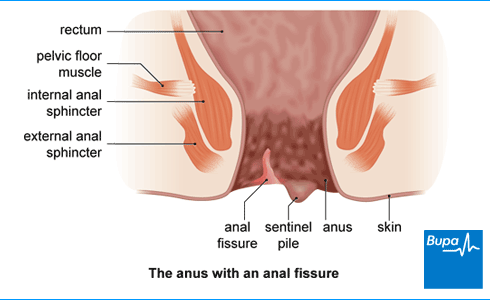 arjay david add passed out anal porn image