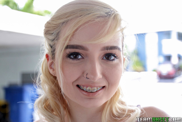 cheryl mcdonald add lexi lore braces image