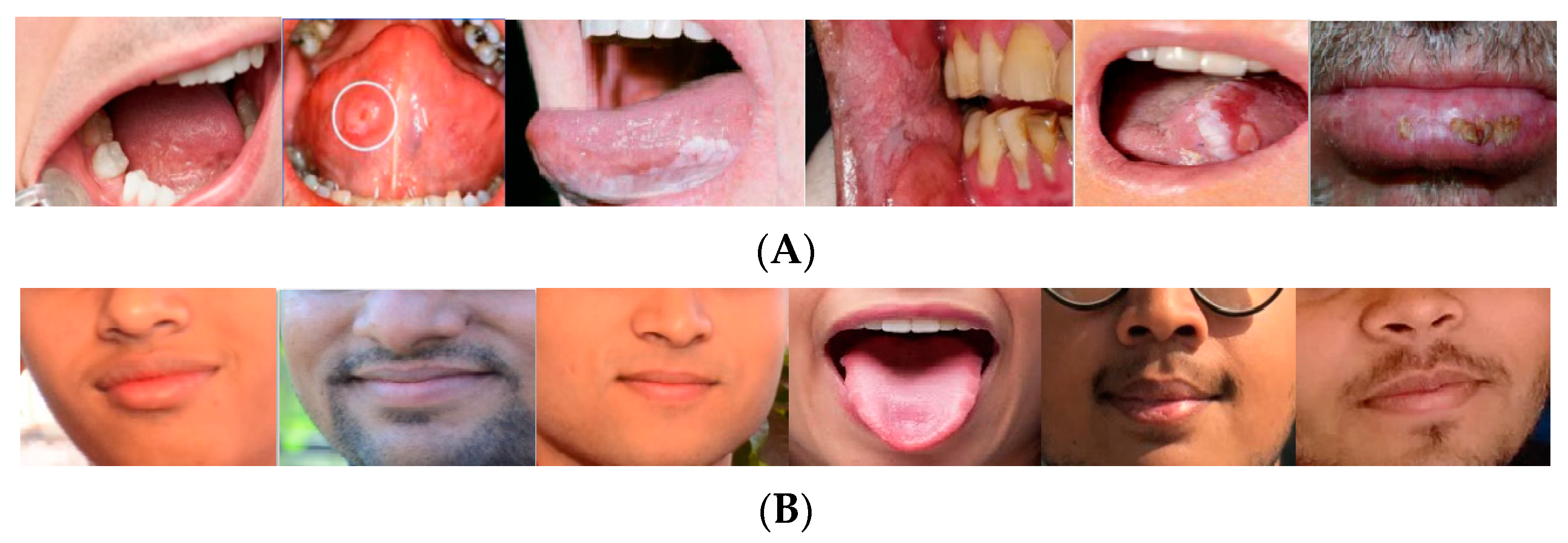 ariyadi purwanto add rough oral photo